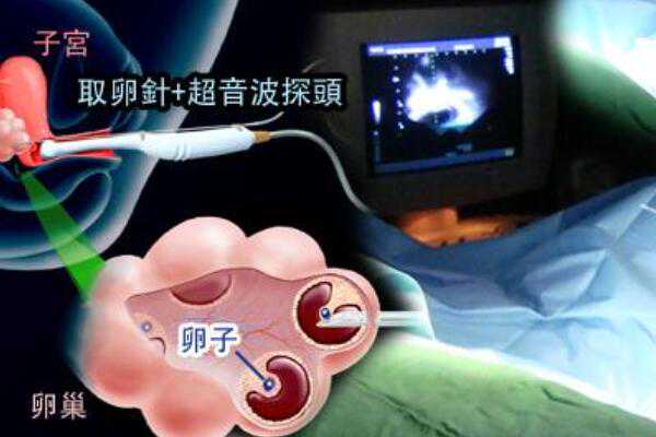 <b>上海哪个私立医院做供卵试管最靠谱？,上海市第六人民医院供卵多少钱一次？</b>