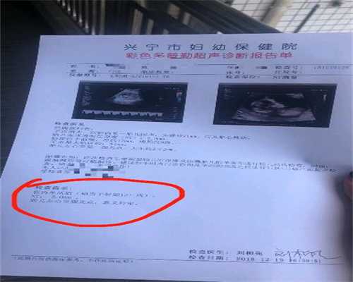 上海世纪助孕供卵试管中心_上海供卵生的孩子有血缘_宫外孕症状的早期表现